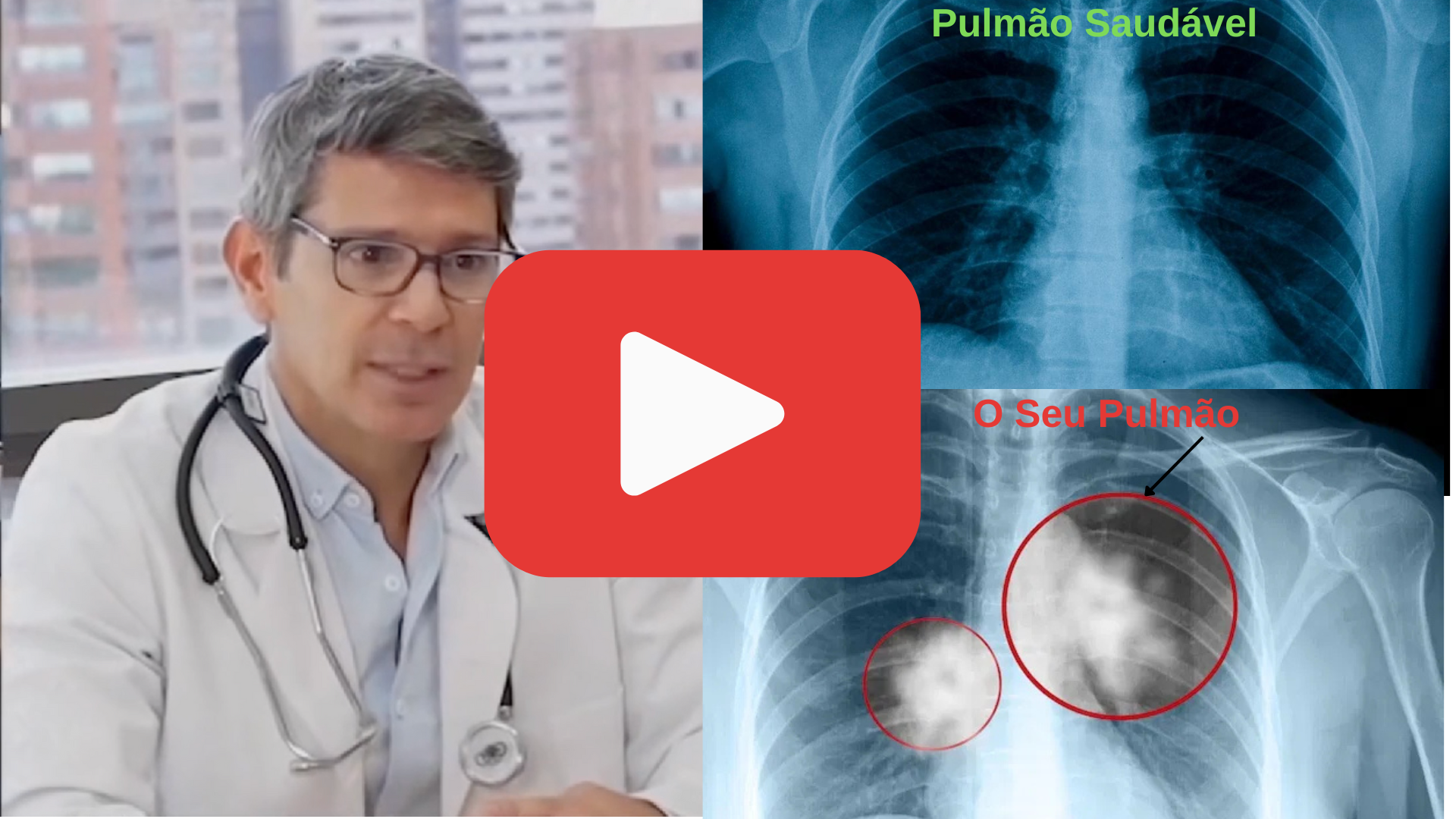 Imagem relacionada à saúde pulmonar